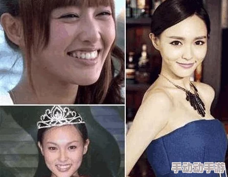 国色天香综合征:某女星被曝患病,真相竟是整容失败引发的后遗症 国色天香综合征:某女星被曝患病,真相竟是整容失败引发的后遗症