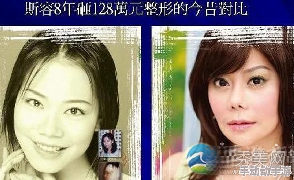国色天香综合征:某女星被曝患病,真相竟是整容失败引发的后遗症 国色天香综合征:某女星被曝患病,真相竟是整容失败引发的后遗症