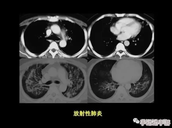 红桃ct：最新进展揭示其在心血管疾病诊断中的潜力与应用前景