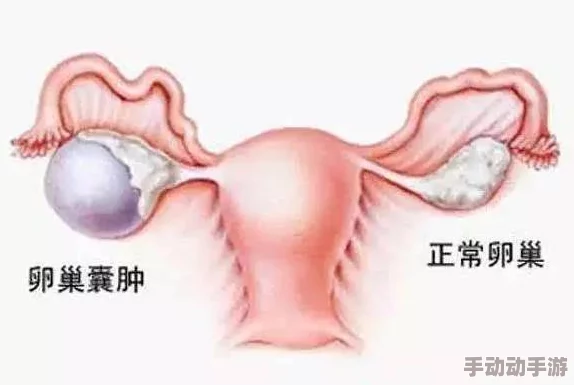 男配每天都在体内成结节,震惊医学界:这种现象竟与日常习惯密切相关,影响深远! 男配每天都在体内成结节,震惊医学界:这种现象竟与日常习惯密切相关,影响深远!