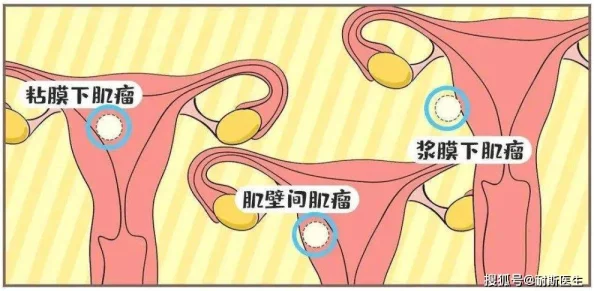 睾丸进入子宫的里面长肉粒正常吗？专家称这可能与某种罕见病症有关，网友热议背后真相！